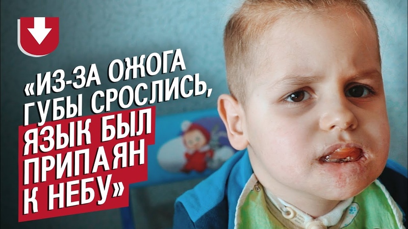 Мой сын выпил кислоту: Катя, Быть