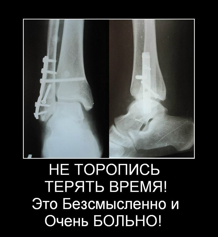 Gregori Po | Киров